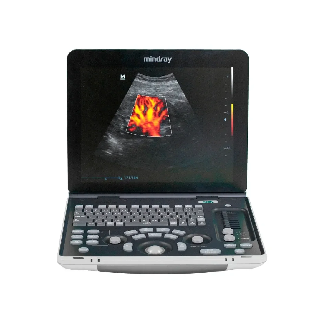 Ветеринарный ультразвуковой аппарат Mindray DP-50, больница для животных, черно-белая цифровая ультразвуковая диагностическая система изображений Ветеринарный ультразвуковой аппарат Mindray DP-50, больница для животных, черно-белая цифровая ультразвуковая диагностическая система изображений