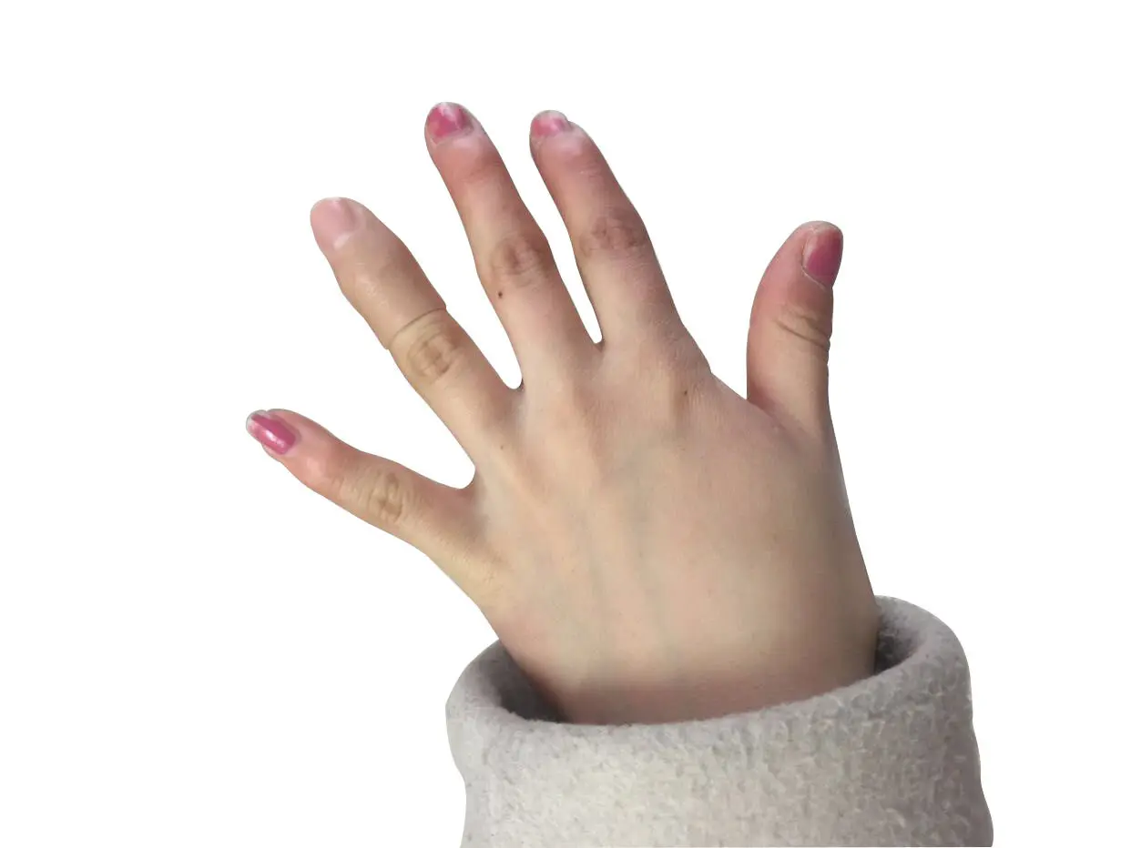 Prosthetics, Fake Fingers, Simulated Toes, Tailor-made.