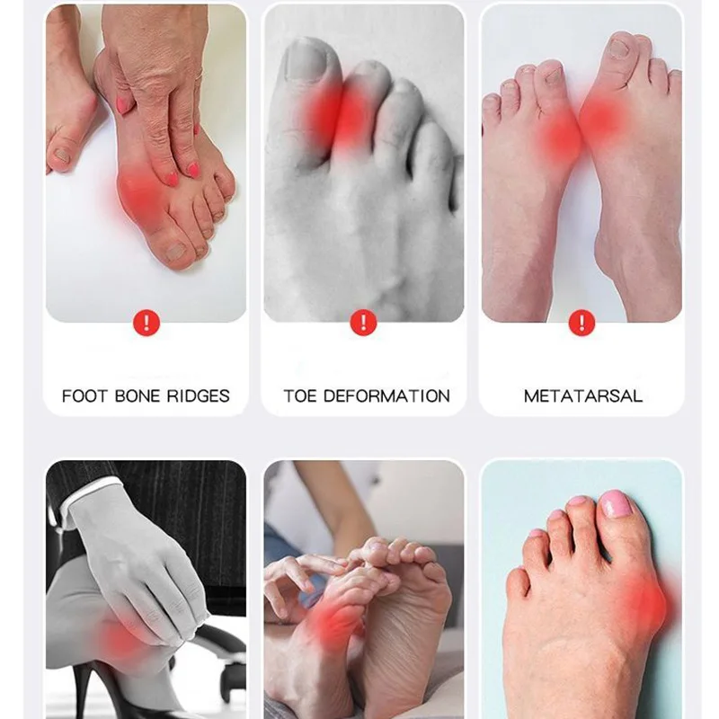 Elektrischer Hallux-Valgus-Korrektor, Zehenglätter mit TENS-Massage zur Schmerzlinderung, Fußpflege, orthopädisch – Detail 9