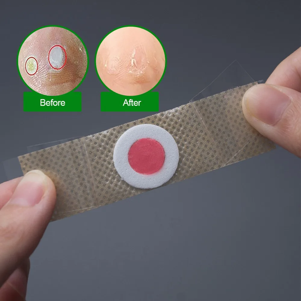 Naklejki do pielęgnacji stóp Plaster medyczny Kurze oko Nagniotki Plastry Usuwanie Nagniotków na stópach Środek na odciski Nauchniki na stópach Plaster na kolce