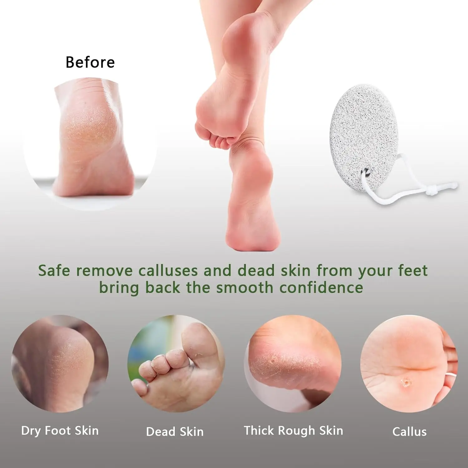 Thumbnail 4 - #13 Top 50 Pumice Stones Worth Buying In 2026