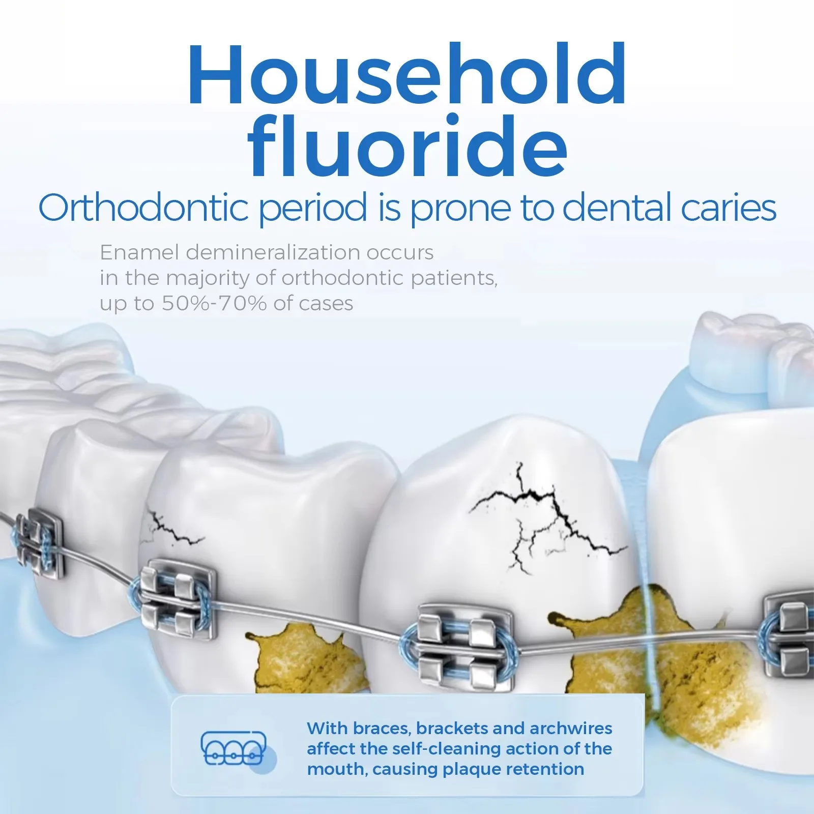 10g Fluoride Foam Dental Caries Prevention Protects Tooth Enamel Fluoride Varnish Gel Orthodontic invisible braces are suitable