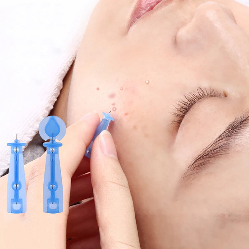 50/100/200 قطعة حب الشباب إبرة المتاح حب الشباب الإبر الدهون الحبوب الجمال العناية بالبشرة أداة مزيل الرؤوس السوداء إبرة النازع