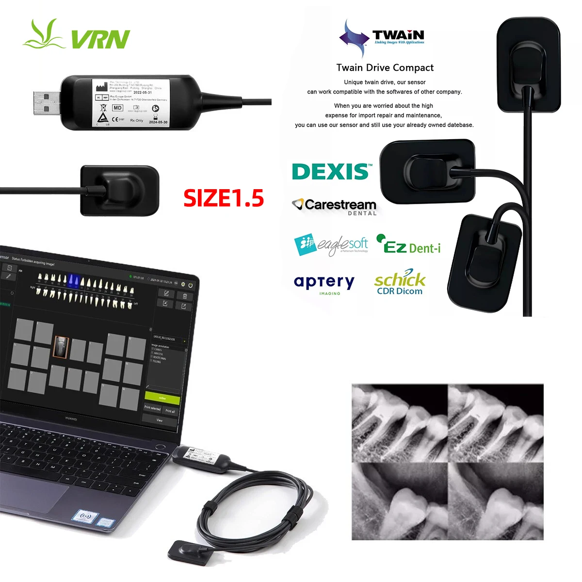 Dental Digital X-Ray Sensor High-Frequency Intraoral Imaging System with HD Image Radiovisography sensor rx digital odontológico