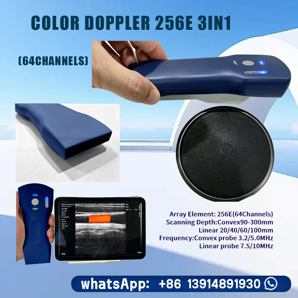 Multiple Display Modes Wireless Triple Function Ultrasound Probe, Convex Linear Phased Array With  Recording Feature
