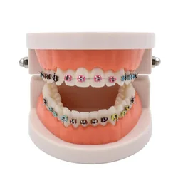 Dentystyczny Model leczenia ortodontycznego z orto metalowym wspornikiem ceramicznym tubka dentystyczna podwiązki laboratorium narzędzi dentystycznych