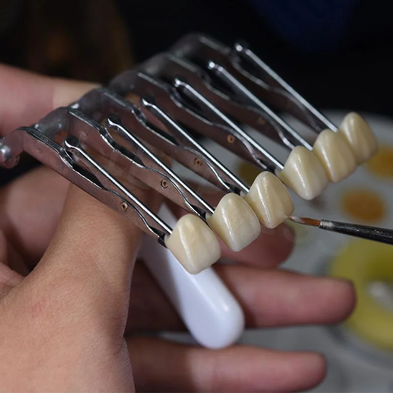 Dental Veneer Inlay Crown Clip Denture Holder Six-tooth Clips