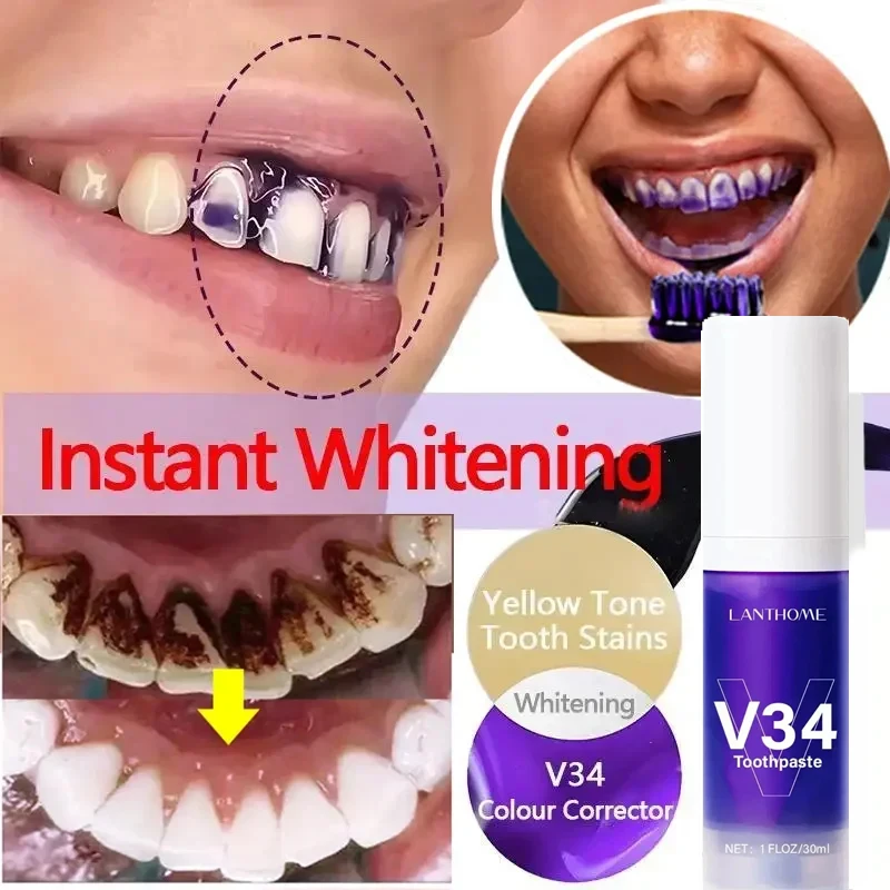 V34 Dentes Branqueamento Mousse Creme Dental, Tooth Care Soro Gel, Remover manchas de placa, Higiene Oral, Hálito Fresco, Ferramentas Dentárias