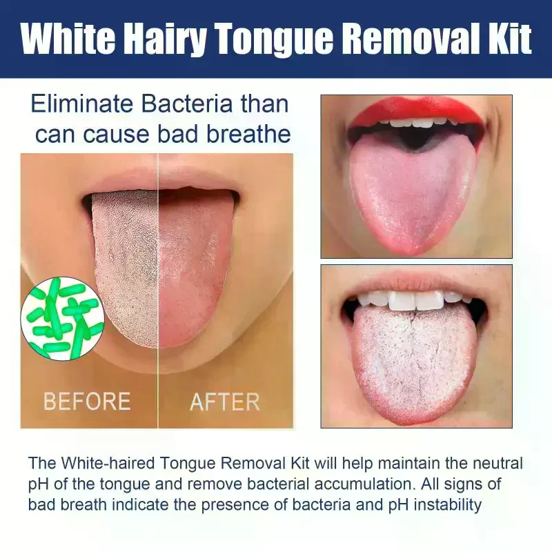Tongue Clean Paste Set Scraping Artifact Fresh Breath Remove Oral Odor Mouth Cleaner Tongue Coating Removal Gel With Brush