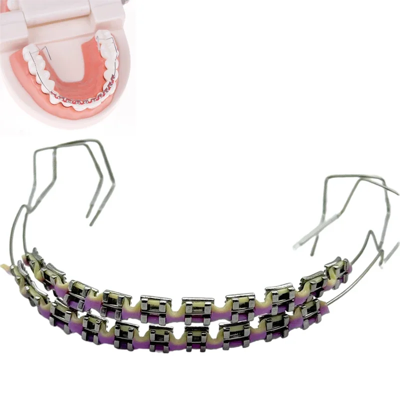 1 زوج ملون اثنين من لهجة الأسنان الأقواس وهمية الديكور الأسنان المؤقتة مع الأسلاك المعدنية قوس ربط أداة طب الأسنان #3