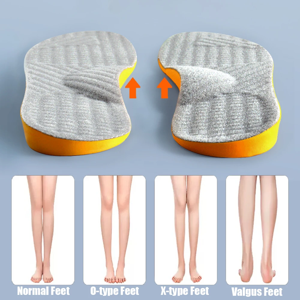 

1Pair Orthopedic Insole Arch Support For Women Men O/X-Leg Pads Foot Care Inserts Shoe Insole For Flat Footed Cushion Protector