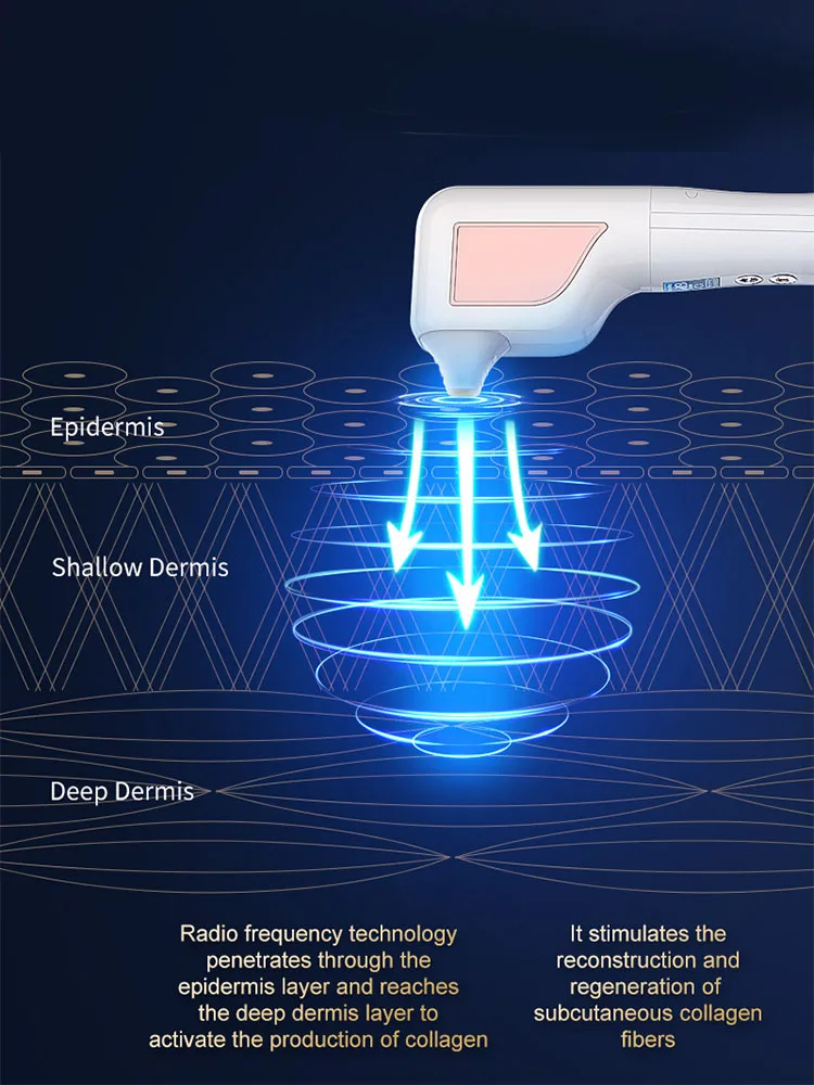 RF Oogzorgapparaat Huidlifting Verlicht vermoeidheid Massage Heet kompres Verminder donkere kringen Oogzwelling Anti-rimpel Schoonheidsoog