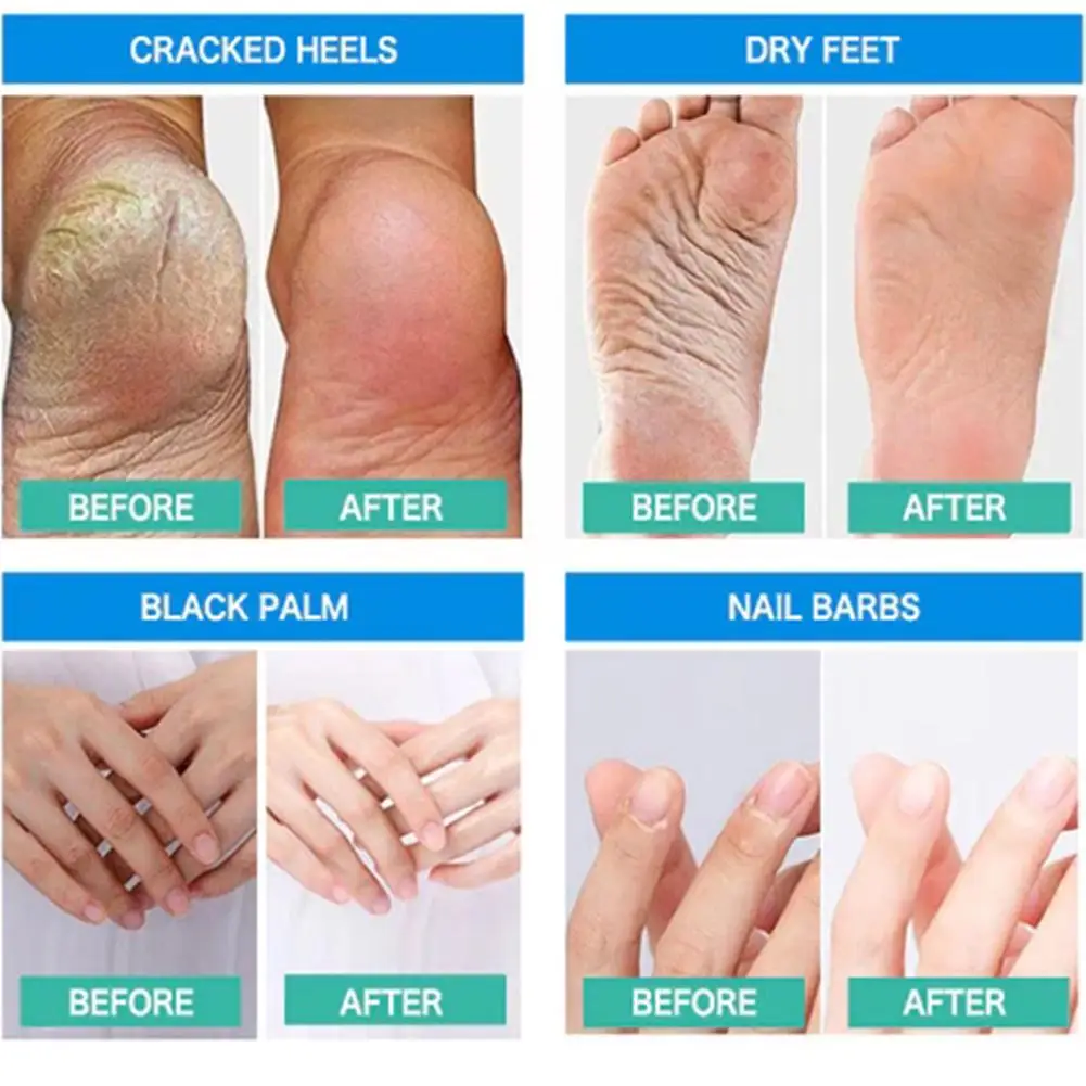 40g Anti-Drying Crack Foot Cream Hand Cracked Smooth Repair Moisturizing Cream Removal Dead Skin Hand Feet Care Skin