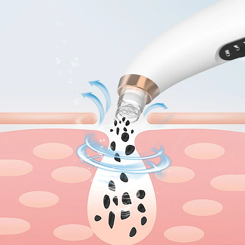 جهاز شفط الرؤوس السوداء الكهربائية الصغيرة فقاعة المسام الأنظف حب الشباب جمال الوجه وجهاز إزالة الرؤوس السوداء