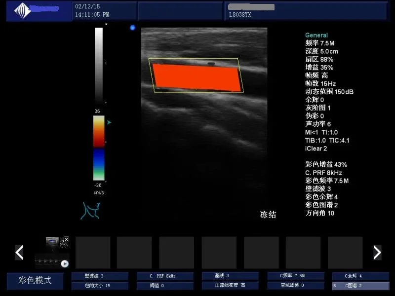 ALG-DU70 Portable  Color Doppler  Full digital 3D or 4D  laptop ultrasound scanner  Medical ultrasound  machine instruments