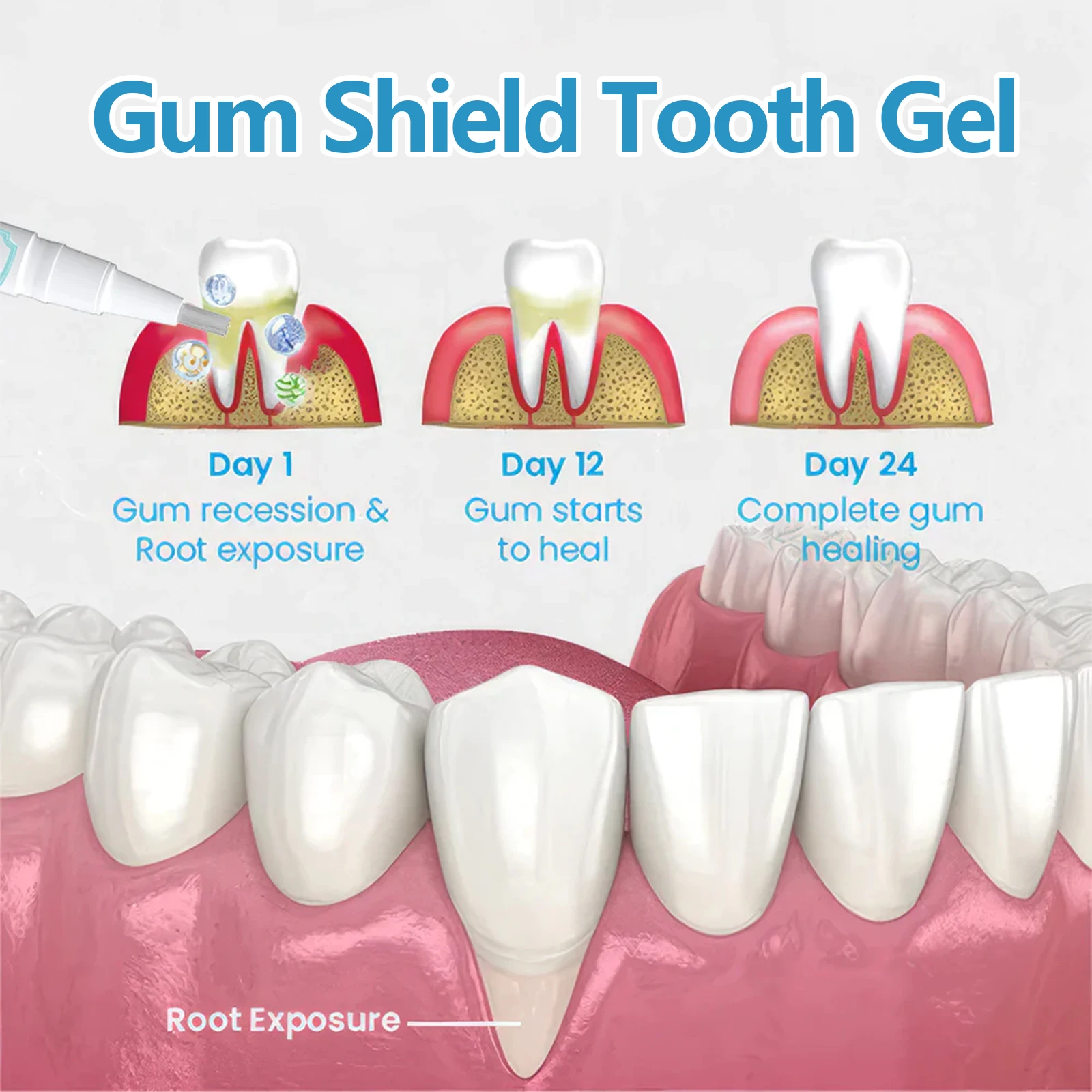 Gel de cuidados bucais de goma melhora a saúde dentária limpa manchas amarelas e tártaro remove mau hálito e odor hálito caneta dentária cuidados bucais