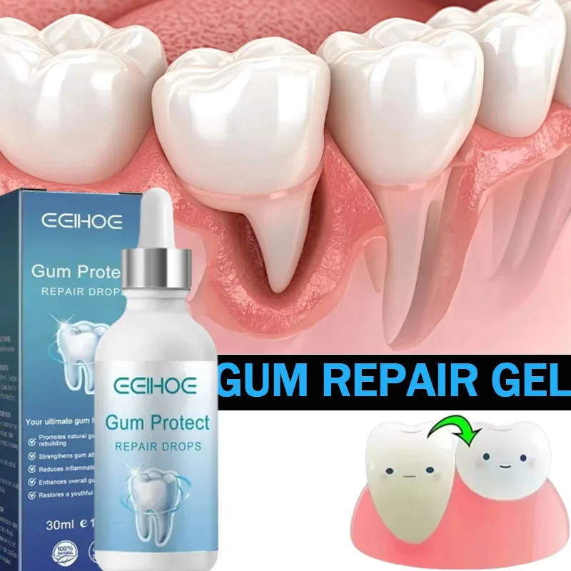 Suero Reparador Rápido para Encías, Alivia Efectivamente la Sensibilidad Dental, Caries, Limpieza Dental, Pasta Dental, Gotas para Aliviar el Daño Dental