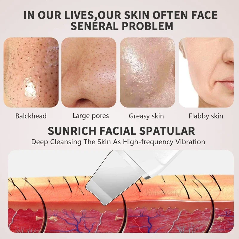 Face Skin Scrubber Deep Cleansing Vibration Massage Facial Cleaner Shovel Spatula Peeling Blackhead Remover Pore Skin Care Tool