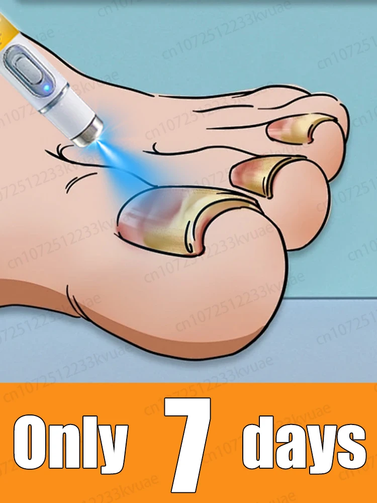 

Скажи прощайте на онихомикоз с научными методами, безопасном и без вторжения.