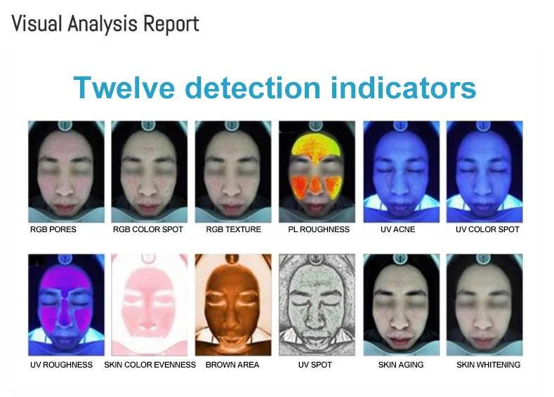 2024 Portable Face Analyzer UV RGB PL 3D Smart Skin Tester Skin Analysis Machine for Sale