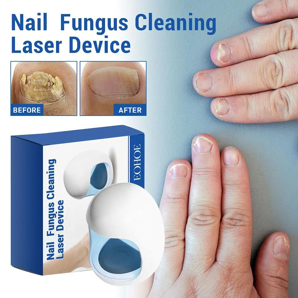 Fungal Nail Laser Device Repair Fast Nails Fungus Onychomycosis Nail Fungus Laser Cleaning Device Feet Health Care