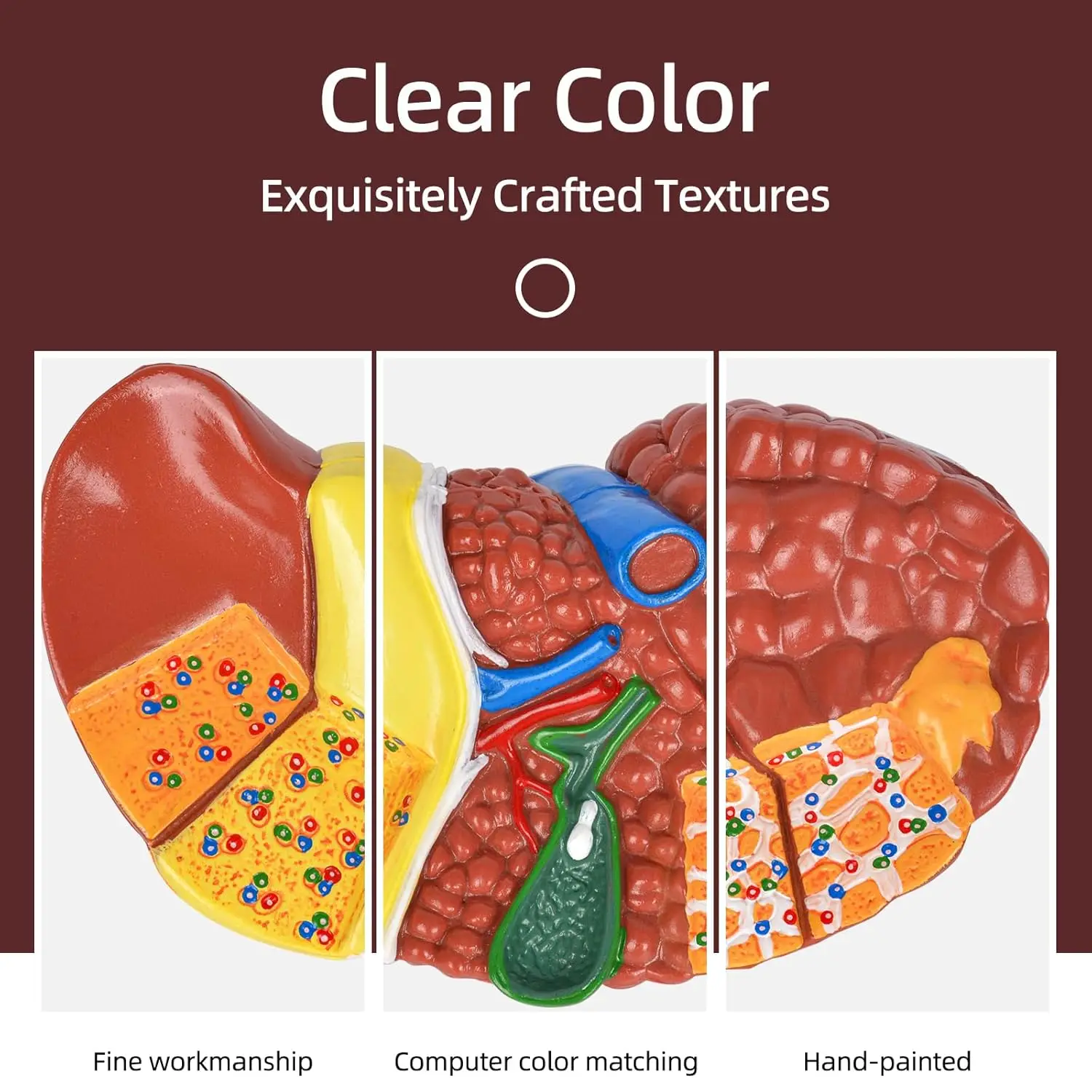 Features Liver Cirrhosis Model Human Anatomical Pathology Liver Clear Texture PVC for School Student Study Research Education
