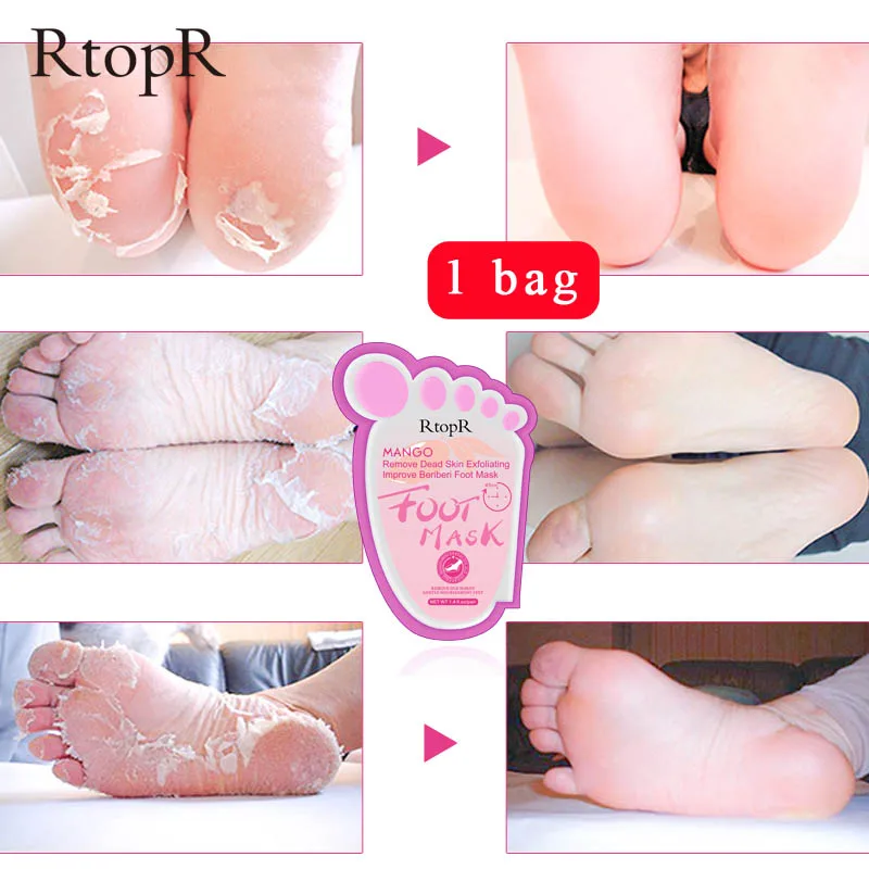 Mango Exfoliating Foot Masks Pedicure Socks Exfoliation Scrub for Feet Mask Remove Dead Skin Heel Foot Peeling Moisturizing Mask