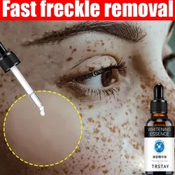 melasma and pekas remover serum,Nature dark spot remover for face,freckle remover cream anti aging cream