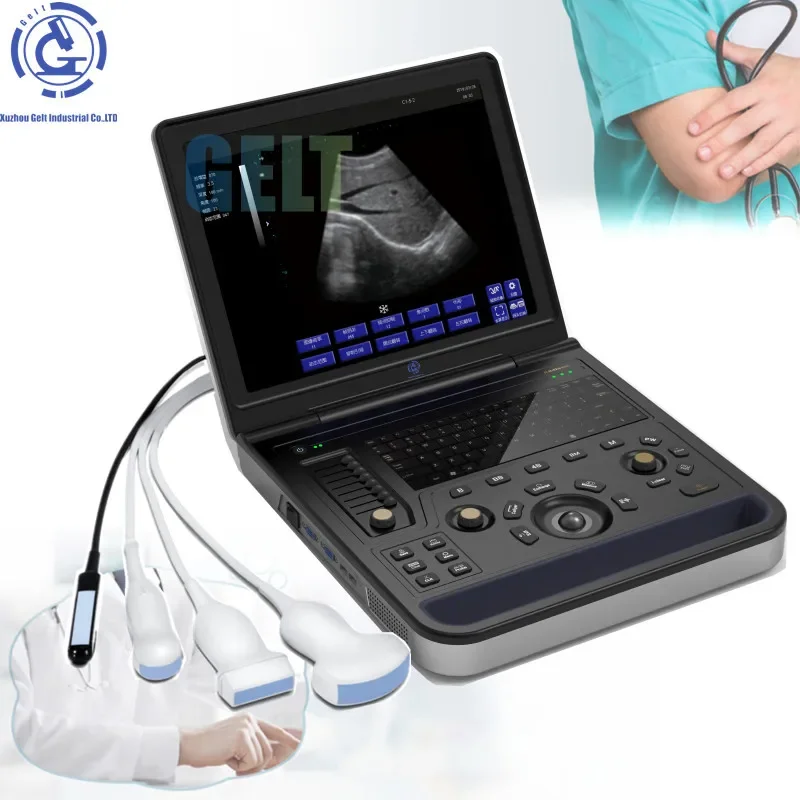 

G-900 Portable laptop style Medical ultrasound scanning machine for hospitals