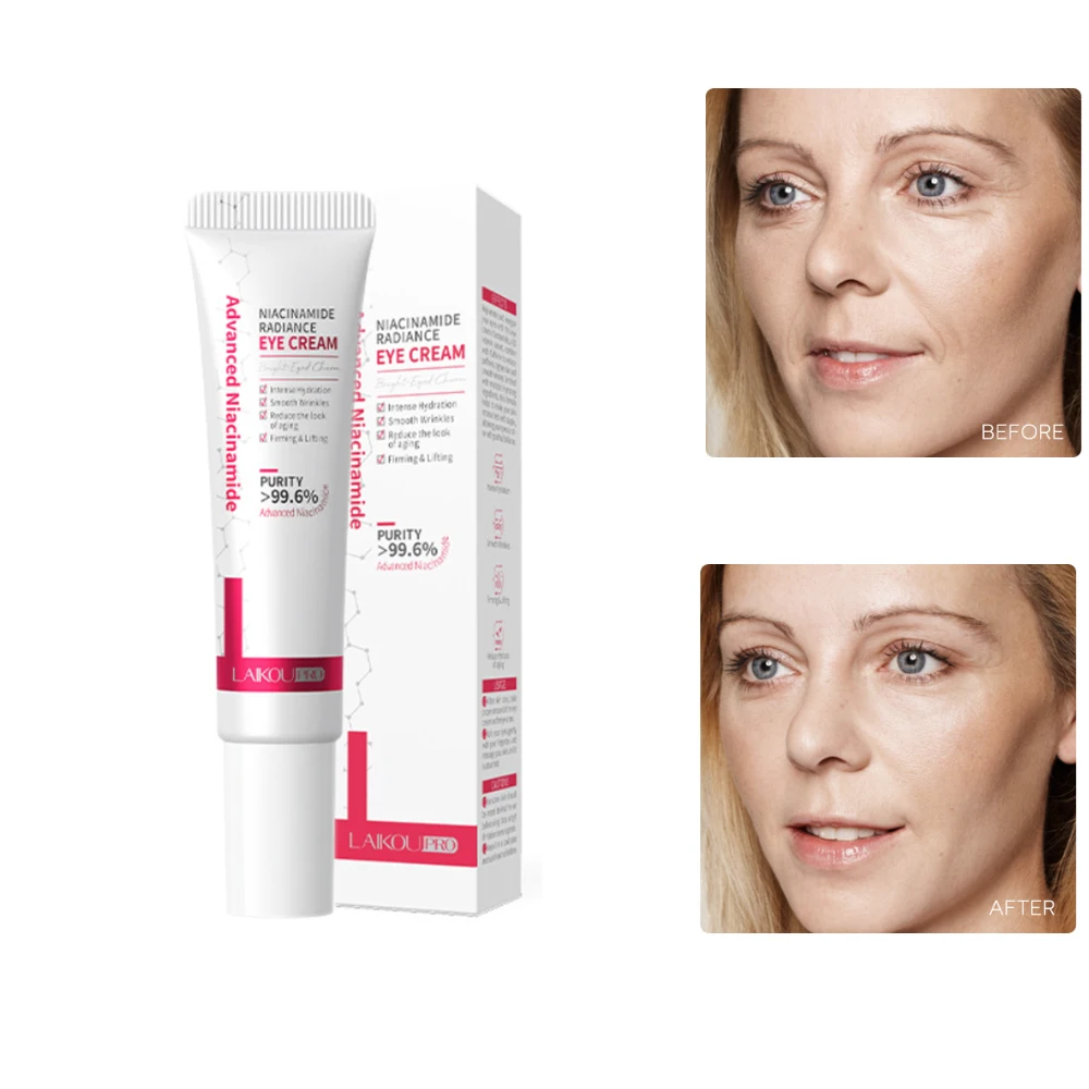 Niacinamide Crema De Ojos Under Eye Dark Circle Remover Anti Age Wallen Onder Ogen Verwijderen Krem Pod Oczy Na Worki Pod Oczami