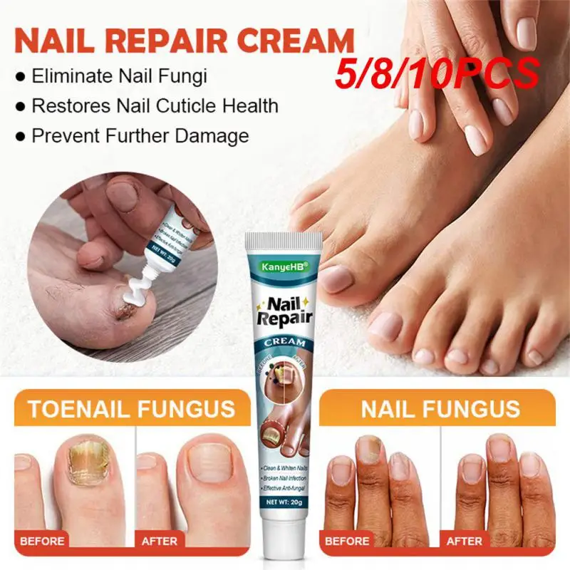 5/8/10PCS Nail Repair Lotion Kill Deep Fungal Multifunction Fingernail Cream Beauty Nail Care Onychomycosis Repair