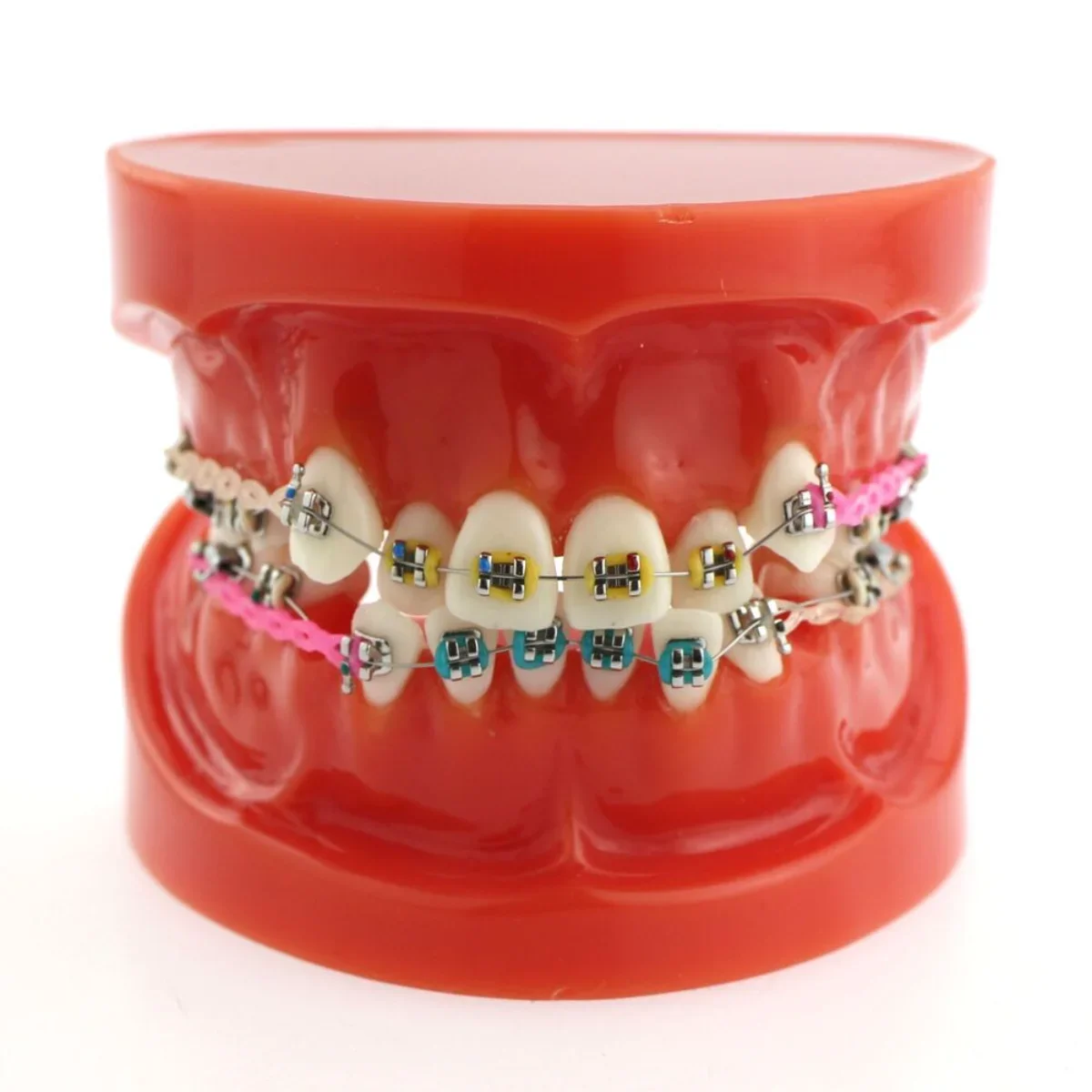 

Dental Orthodontic Treatment Teeth Model Malocclusion Correction with Metal Brackets Teaching Model for Dental Teaching Resource