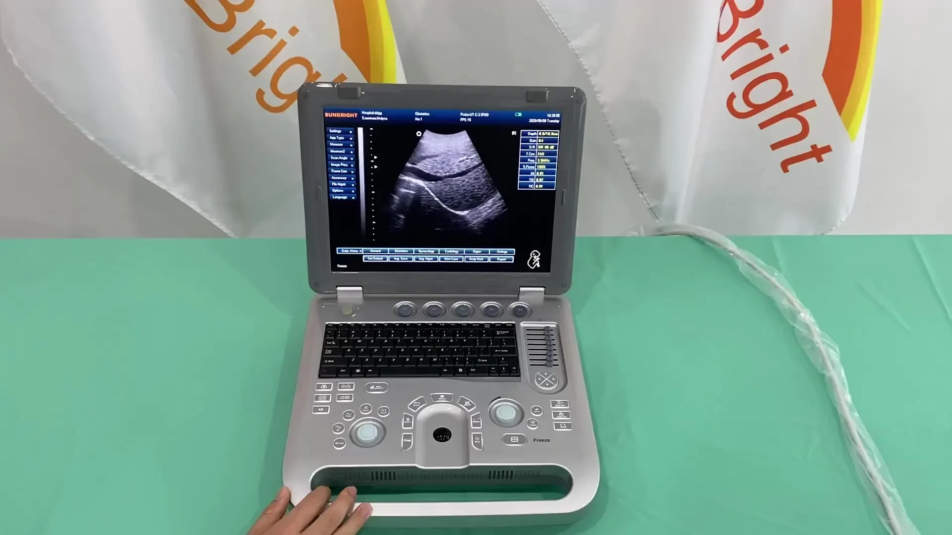 

Sunbright clinic diagnostic ultrasound with convex linear probe