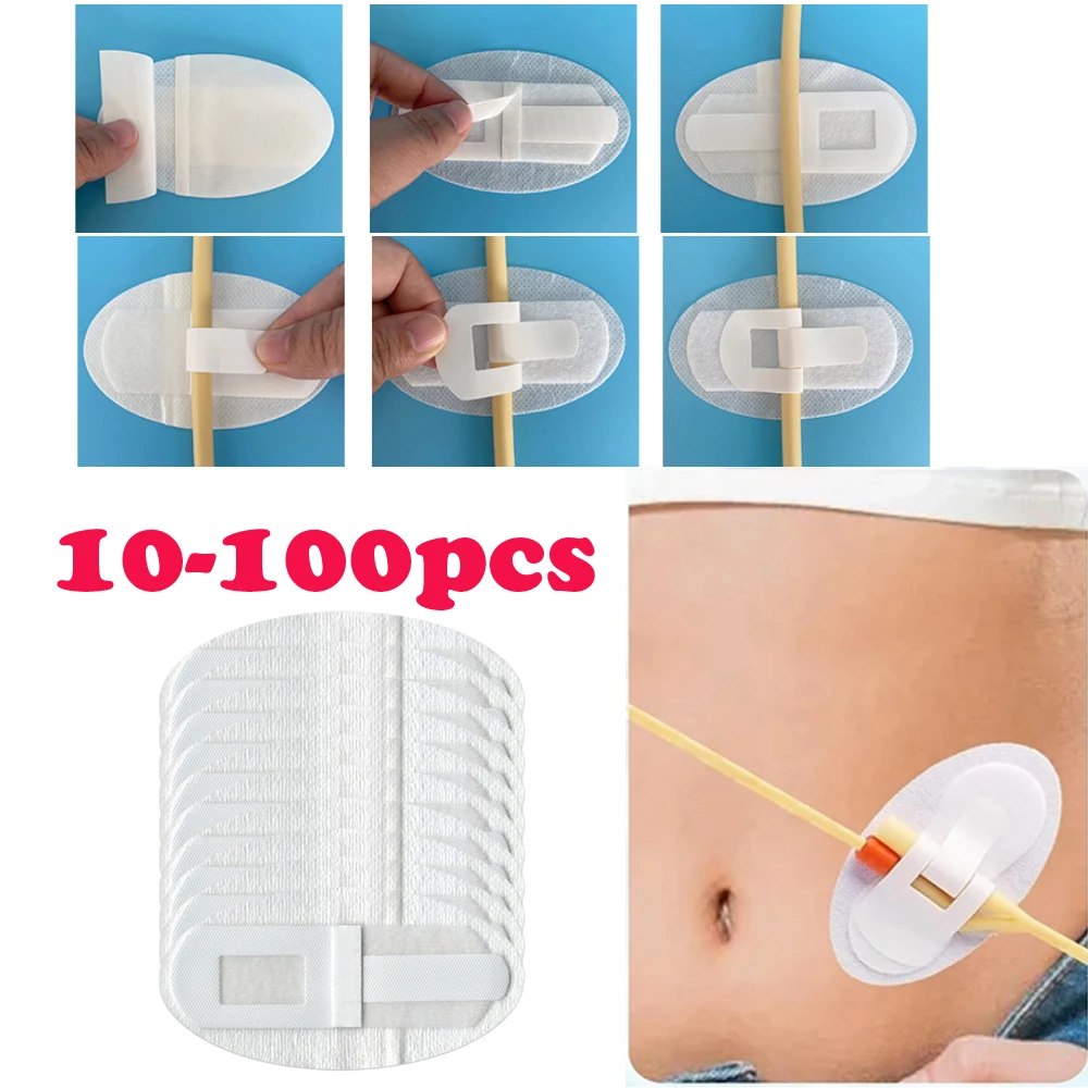 

10-100 шт. устройство для стабилизации катетера, держатель трубки катетера, клейкий катетер, сумка для мочевой ноги, держатель ленты для ног