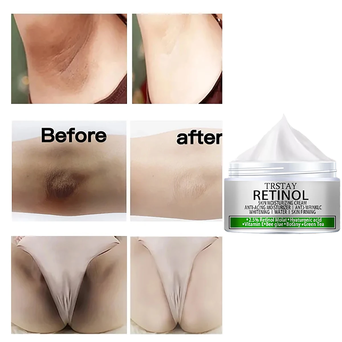 Armpit Whitening Cream Skin Lightening Bleaching Cream For Underarm Dark Skin Legs Knees Whitening Intimate Body Lotion