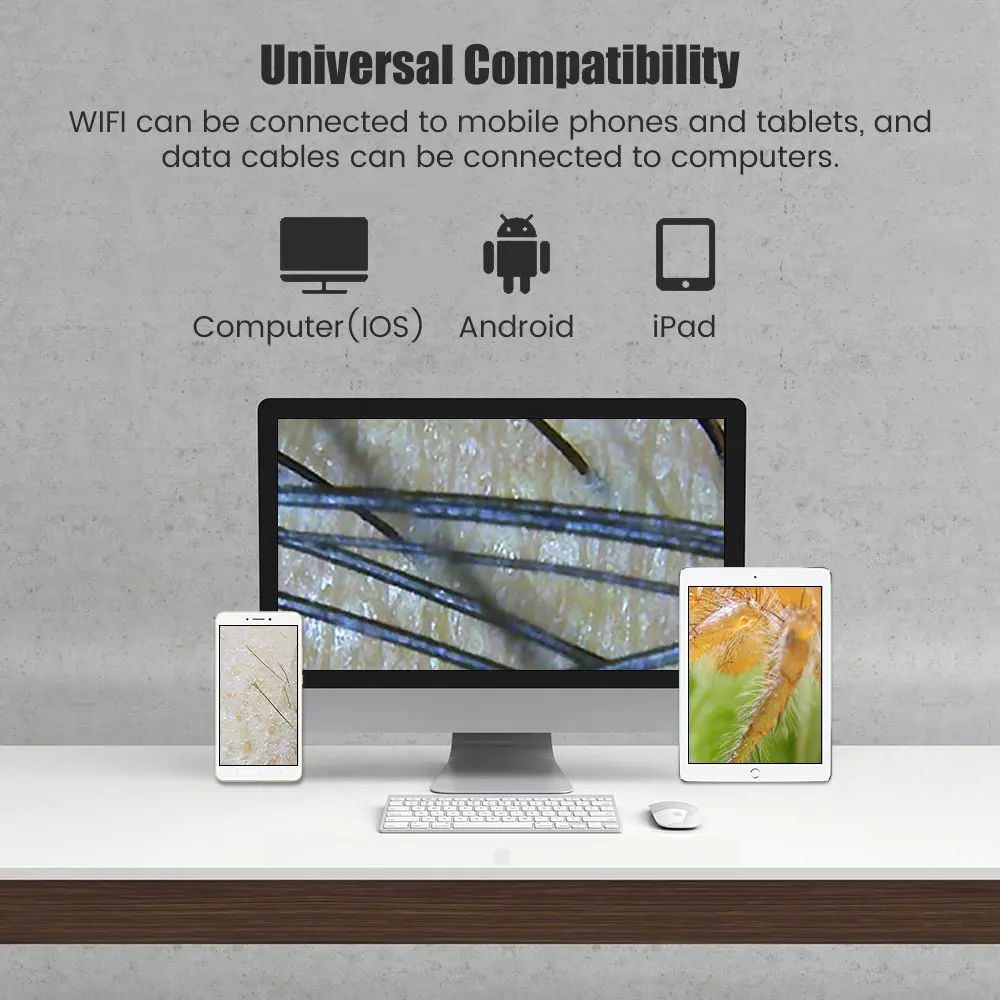 Usb Draagbare Digitale Elektronenmicroscoop Voor Huid Analyzer Usb Hoofdhuid Detector Microscoop