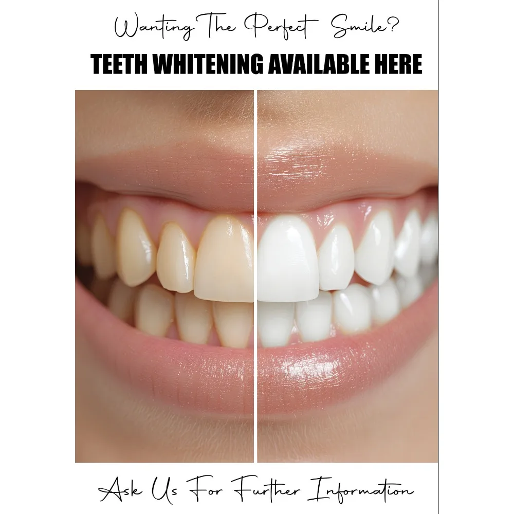 Teeth Whitening Available Here Dentist Oral Clinic Cuadros HD Decorative Posters Wall Art Pictures Canvas Paintings Home Decor
