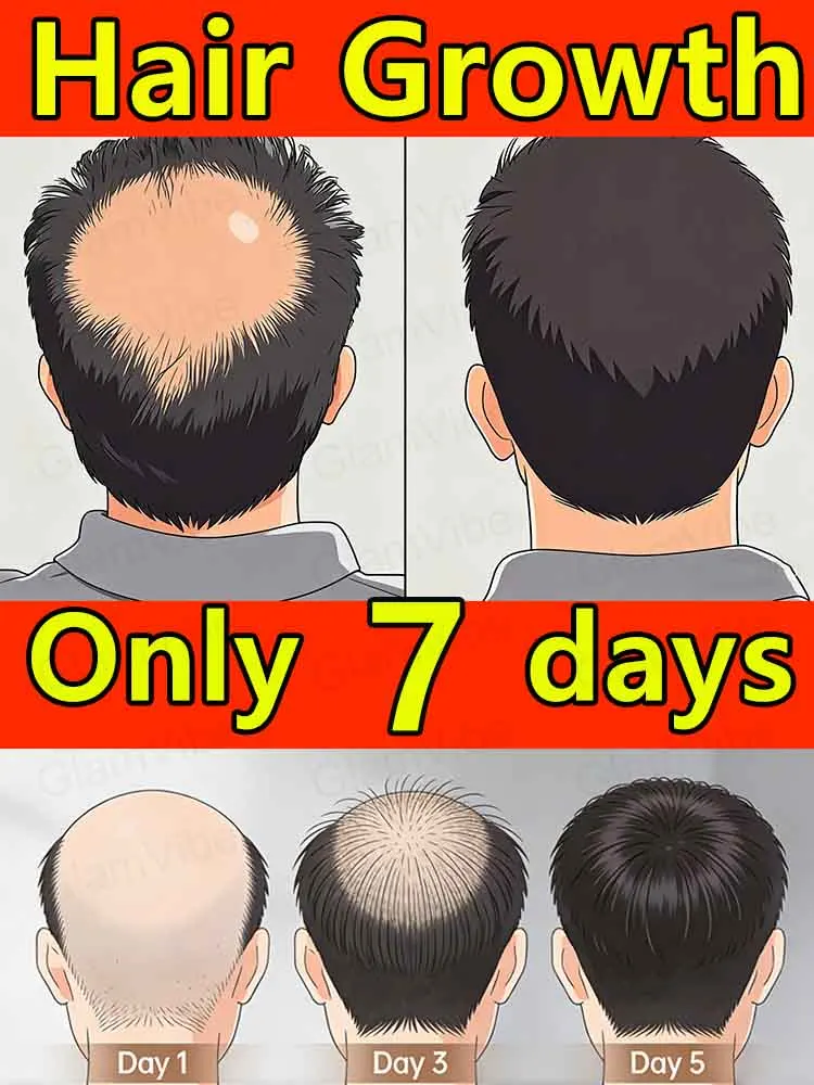 

ᔆᵗⁱᵐᵘˡᵃᵗᵉ ʰᵃⁱʳ ᶠᵒˡˡⁱᶜˡᵉˢ ᵗᵒ ᵖʳᵒᵈᵘᶜᵉ ⁿᵉʷ ᵍʳᵒʷᵗʰ‧ Time is running out, take action now!