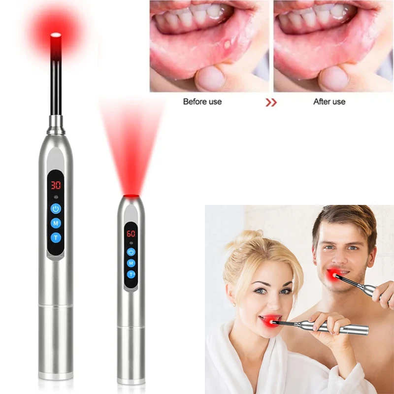 2024 Cold Sore Laser Light Therapy Device Canker Sore Treatment Infrared Wand for Mouth Nose Ear Knee Feet Hands Ankle Skin Care