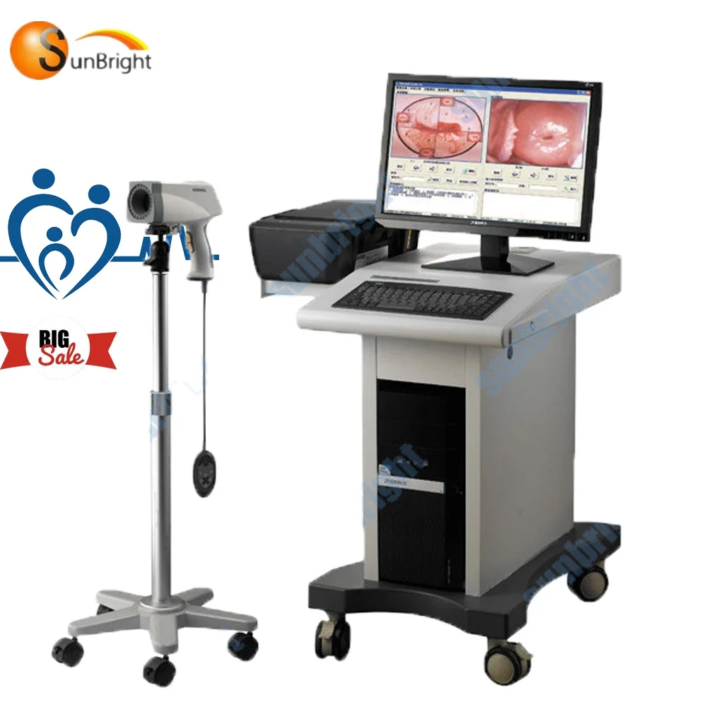 Electronic Colposcope color digital with CCD Sony  CE