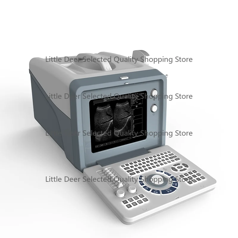 

Высококачественный полнофункциональный цифровой диагностический сканер S218 (черно-белый) с дисплеем CRT