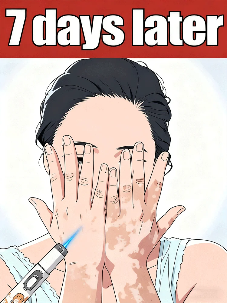 

ᴺᵉʷ ˡᵃˢᵉʳ ᵛⁱᵗⁱˡⁱᵍᵒ ʳᵉᵐᵒᵛᵃˡ ᵉᑫᵘⁱᵖᵐᵉⁿᵗ ⁱⁿ ²⁰²⁵ Blue laser care vitiligo