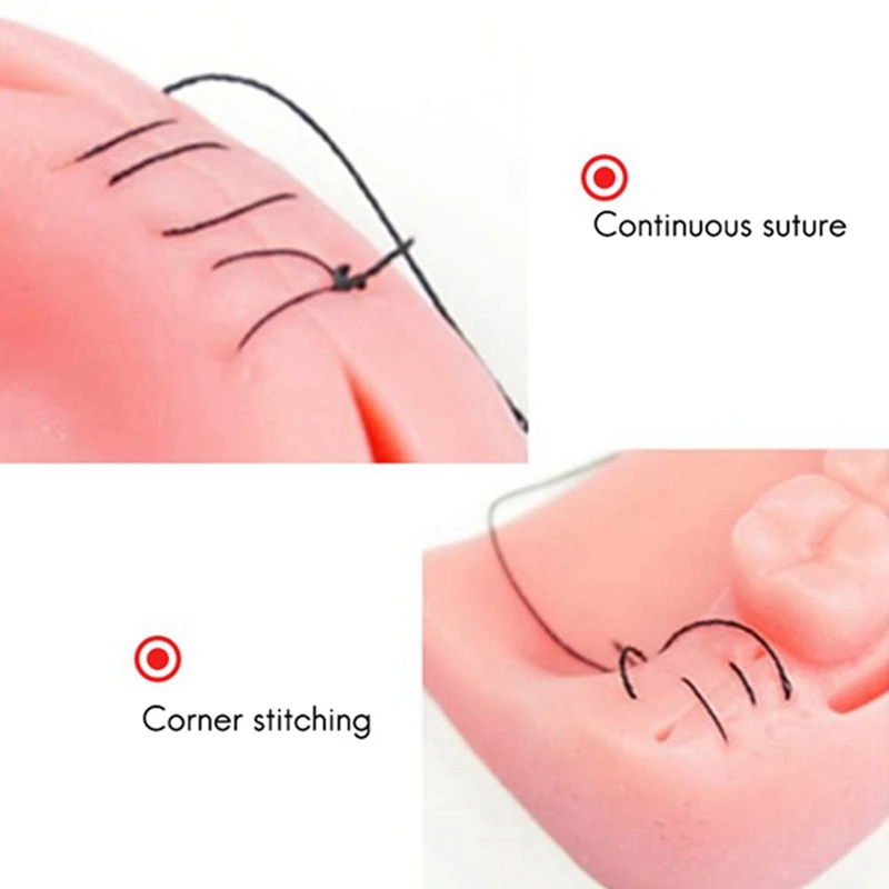 طقم تدريب سيليكون على خياطة الأسنان الفموية الاصطناعية ، ممارسة طبيب الأسنان والتدريب ، الأنواع الشائعة من الجروح