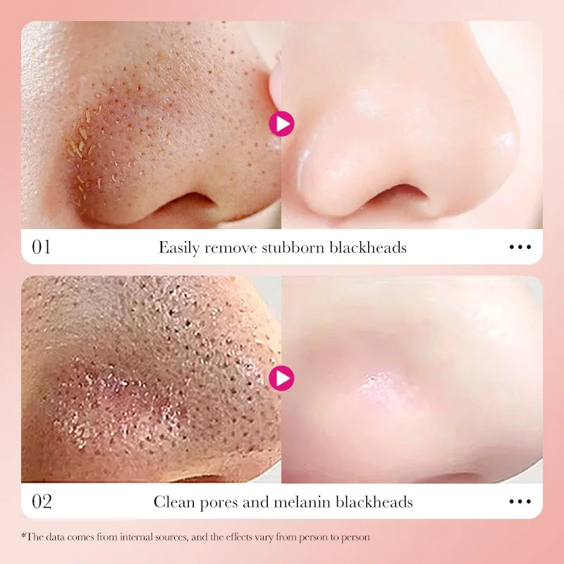 Masque anti-points noirs au charbon de bambou 20oer, bandes antarctrices, rétrécissement des pores, nettoyage en profondeur, peau douce et délicate, pack antarctique