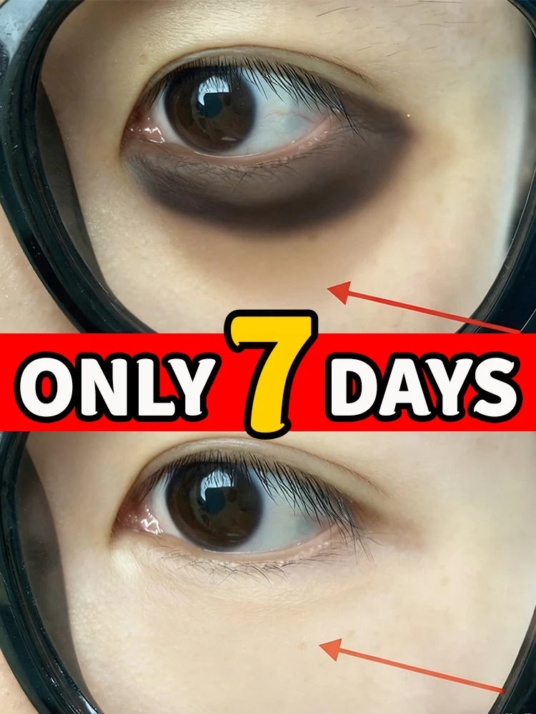 

[2025 Patented ᴾᵉᵖᵗⁱᵈᵉ ᴱʸᵉ ᶜʳᵉᵃᵐ] Reshapes the youthful contours of the eye area