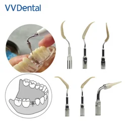 VV Dental Ultrasonic Scaler Tips for Cleaning Implant Ceramic Orthodontic Teeth fit EMS WOODPECKER-UDS Handpiece Dental Scaler
