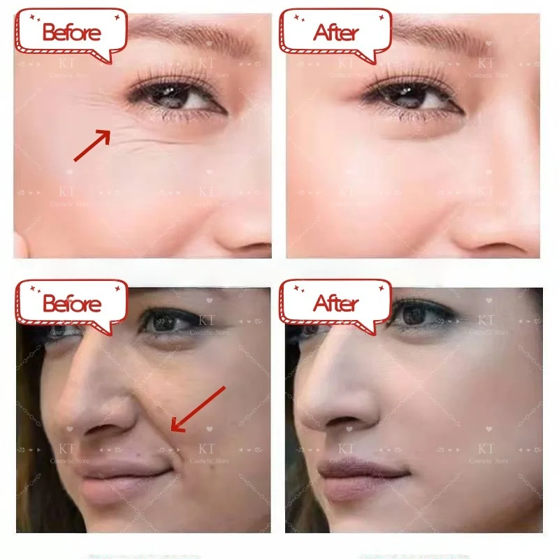 

100g Jelly Face Cream Collagen Soft Spa Nourishing Moisturize Face Shrinks Pores Remove Comedones Jelly Essence Korean Skin Care