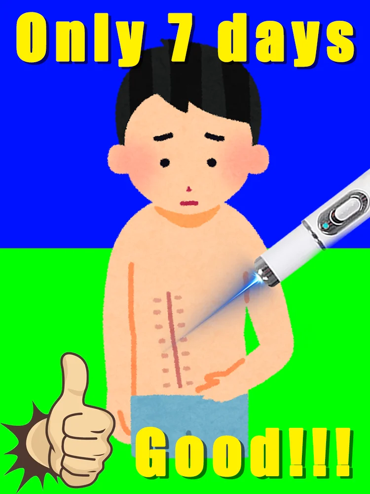 Bolígrafo de luz azul para resolver cicatrices, envío gratis, herramientas para el cuidado de los cicatrices, indoloro, uso doméstico, fácil de usar