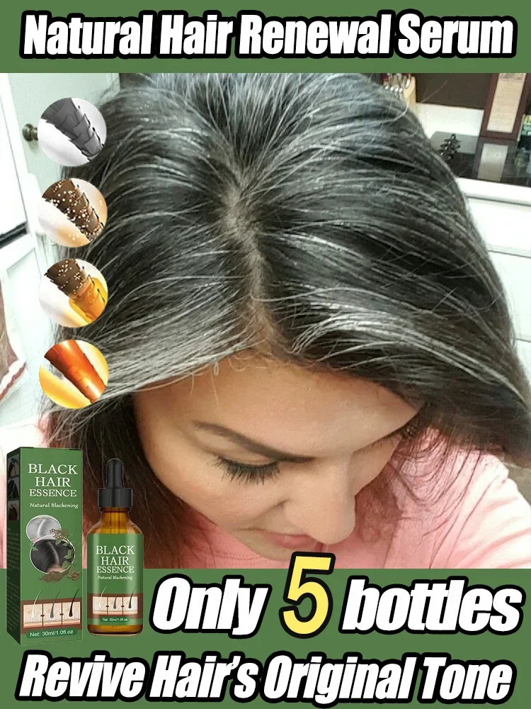 رمادي أبيض علاج الشعر مصل سائل أبيض إلى أسود اللون الطبيعي إصلاح تغذية مكافحة رمادي مكافحة فقدان الرعاية الرجال النساء