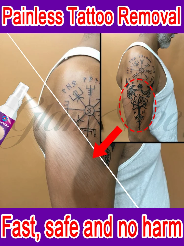

Rapid tattoo removal spray, easily removes tattoos of all kinds